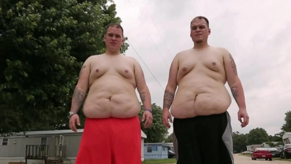 Extreme Weight Loss Season 3 Streaming: Watch & Stream Online via Hulu